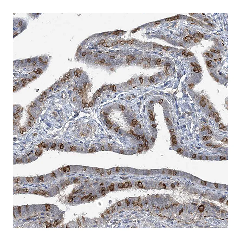 Atlas Antibodies Anti-CDS1 Antibody