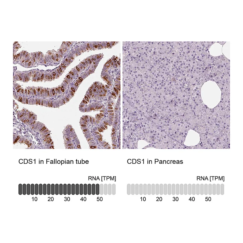 Atlas Antibodies Anti-CDS1 Antibody
