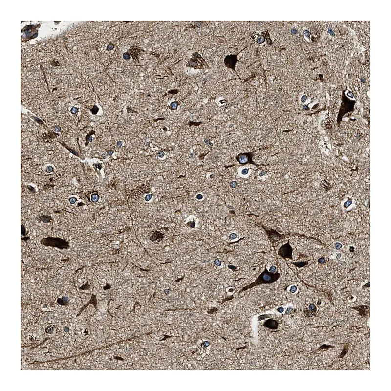 Atlas Antibodies Anti-CDS2 Antibody