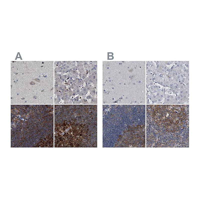 Atlas Antibodies Anti-CDV3 Antibody