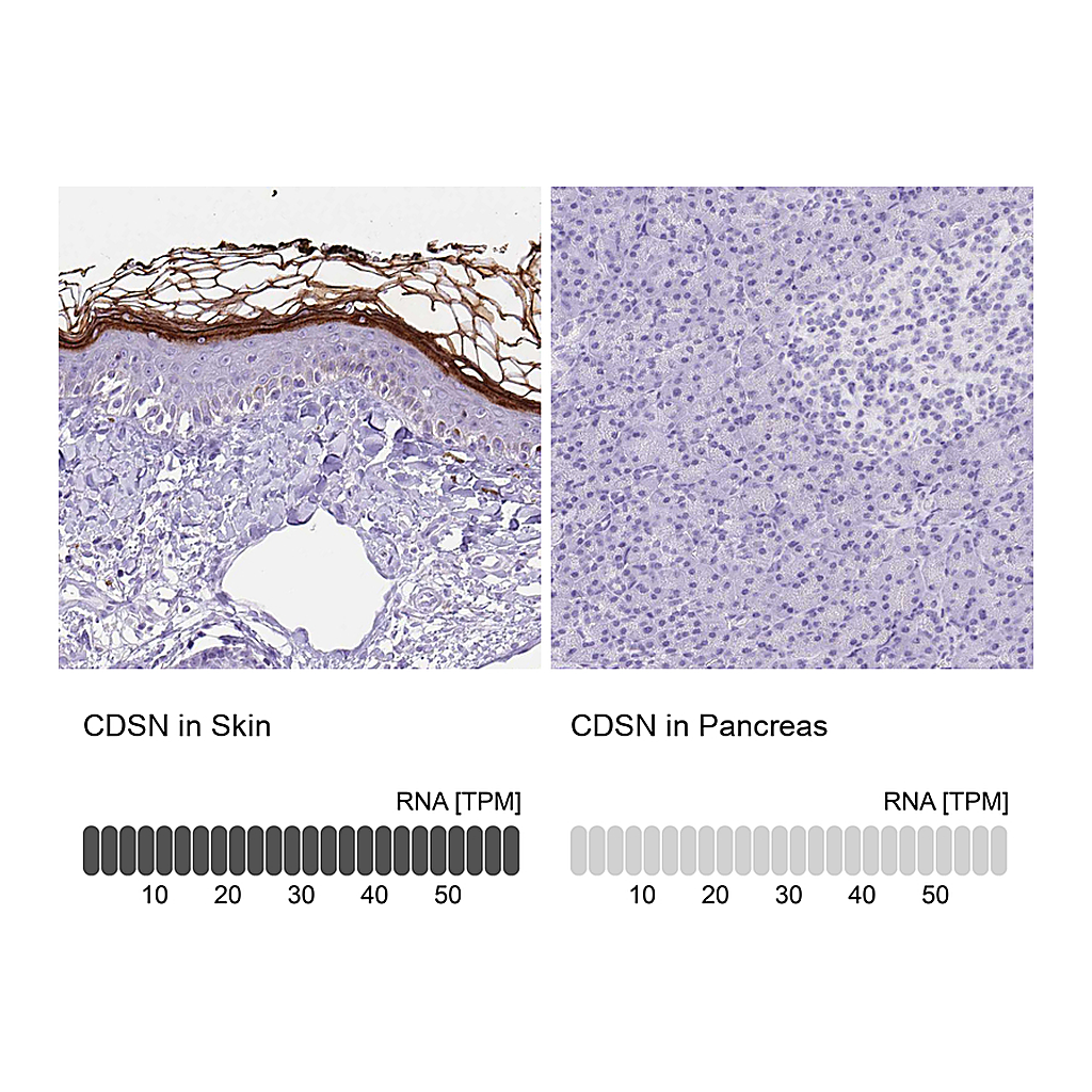 Atlas Antibodies Anti-CDSN Antibody