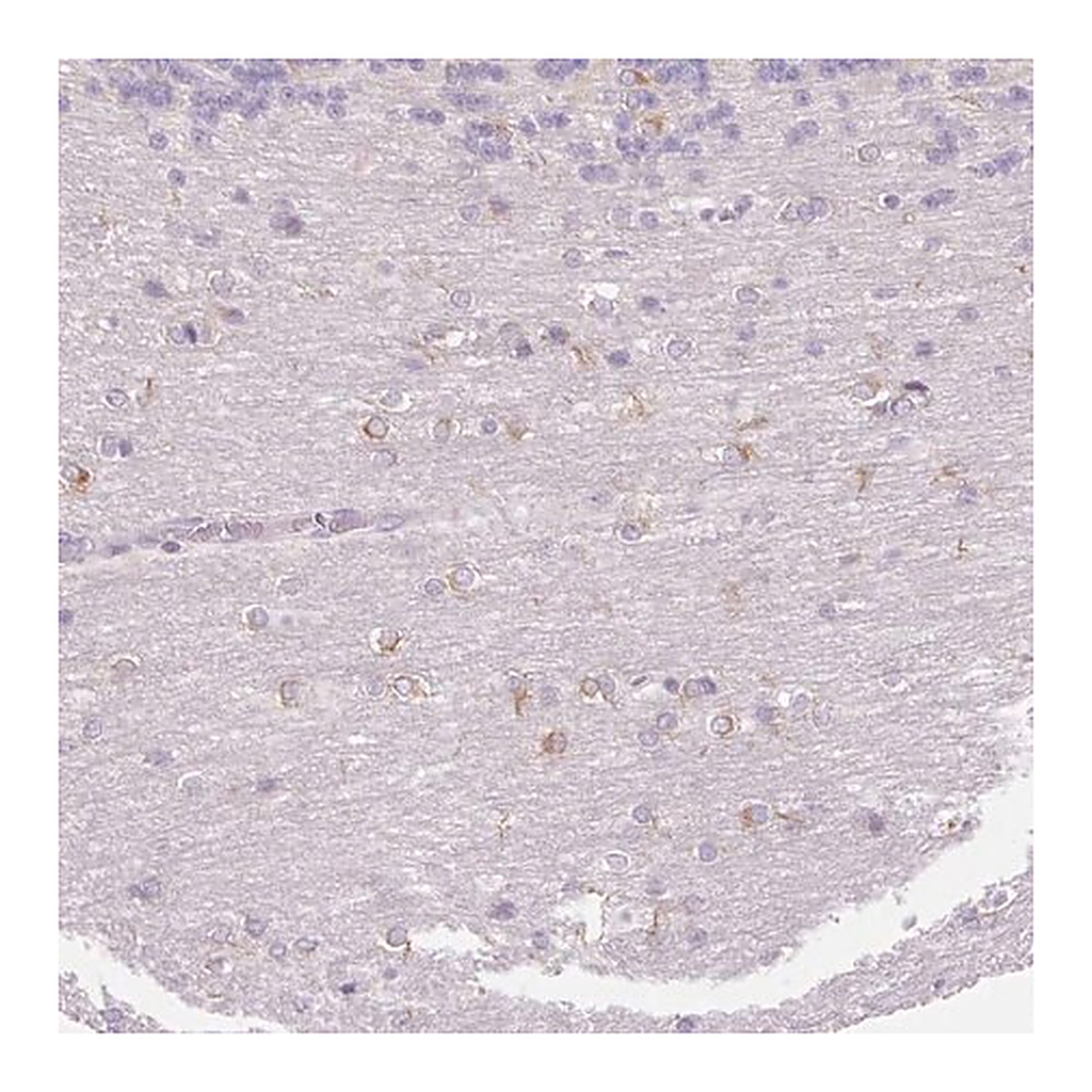Merck Anti-FOCAD antibody produced in rabbit