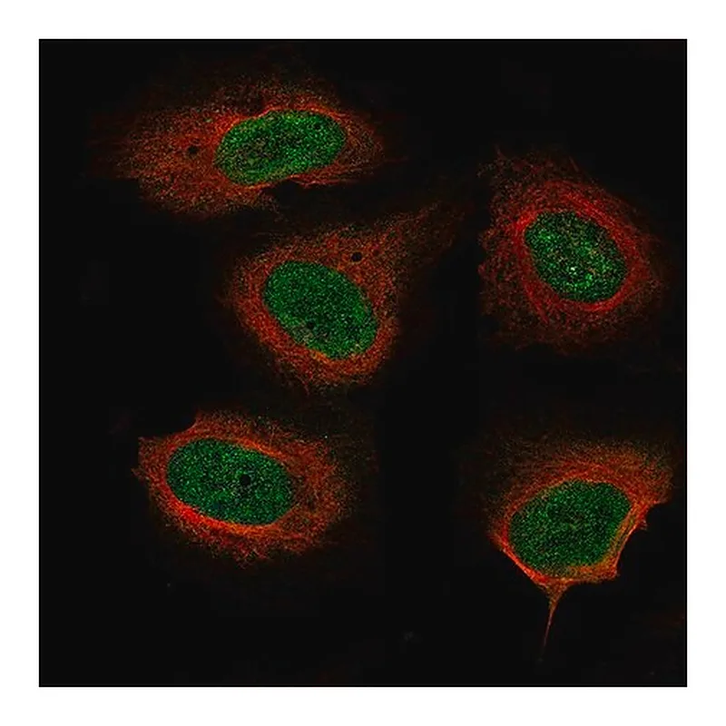 Merck Monoclonal Anti-NF1 antibody produced in mouse