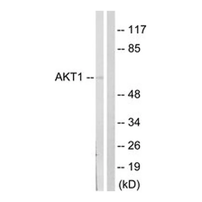 Merck ANTI-AKT