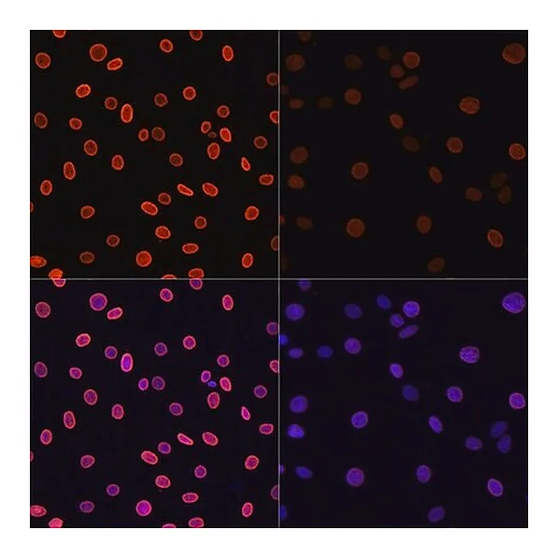 Merck Anti-Acetyl-Histone H4-K91 antibody produced in rabbit