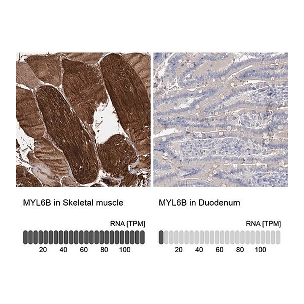 Merck Anti-MYL6B antibody produced in rabbit