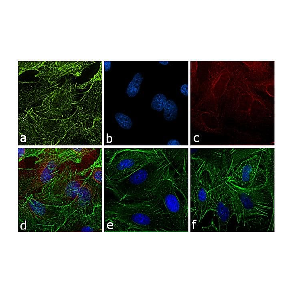Thermo Fisher Scientific Rabbit anti-Rat IgG (H+L) Secondary Antibody, Texas Red
