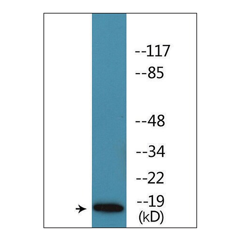 Merck Anti-phospho-Caveolin 2 (pTyr27) antibody produced in rabbit