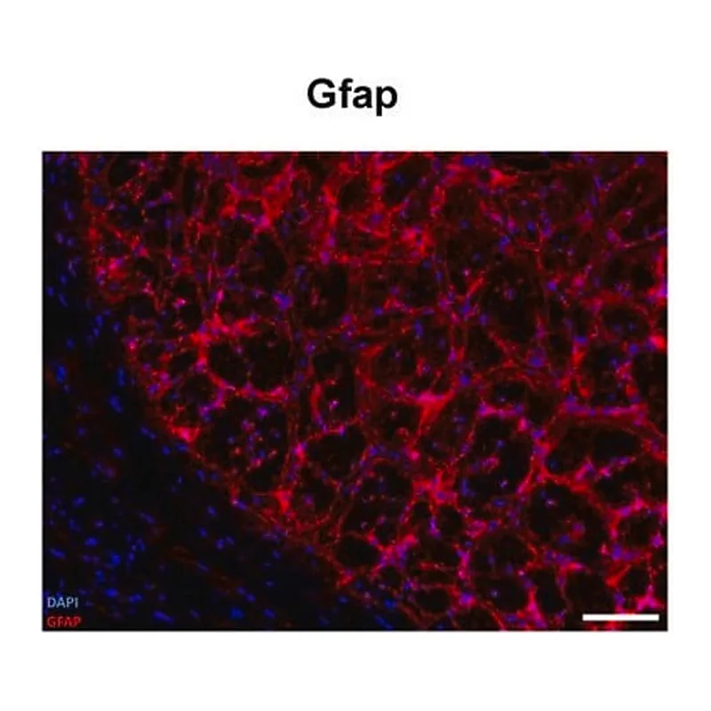 Merck Anti-GFAP antibody produced in rabbit
