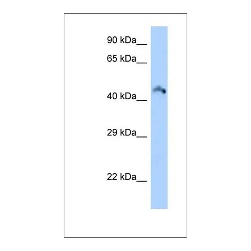 Merck Anti-RIMKLB antibody produced in rabbit