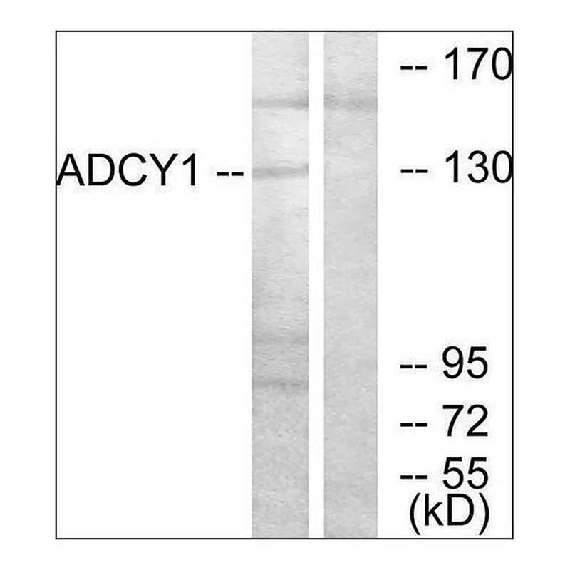 Merck Anti-ADCY1 antibody produced in rabbit