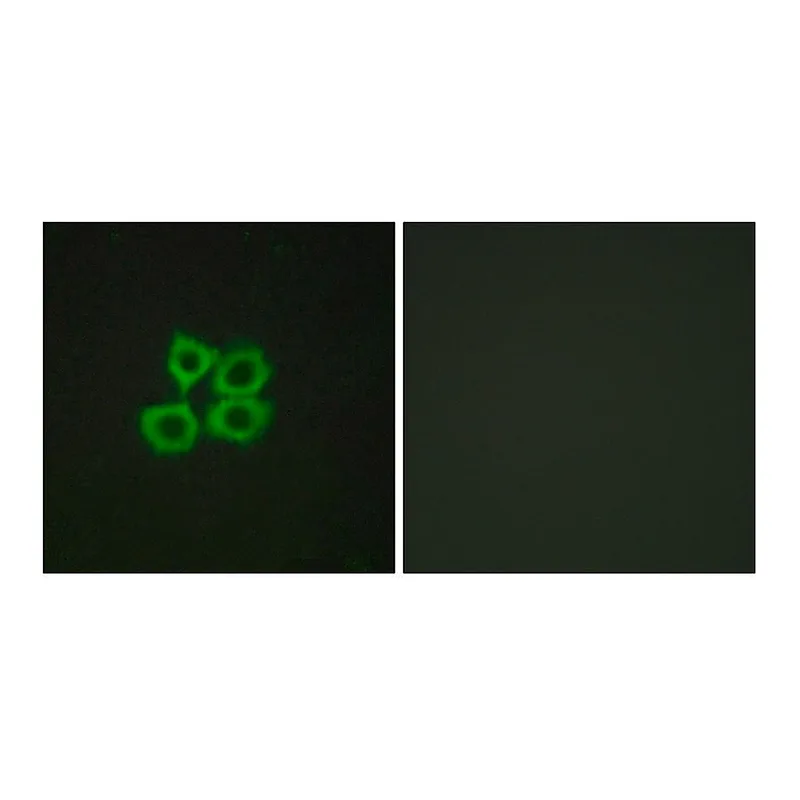 Merck Anti-CRHR2 antibody produced in rabbit