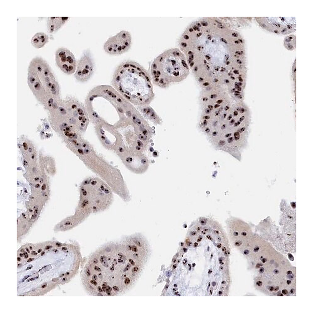 Merck Anti-RSL1D1 antibody produced in rabbit