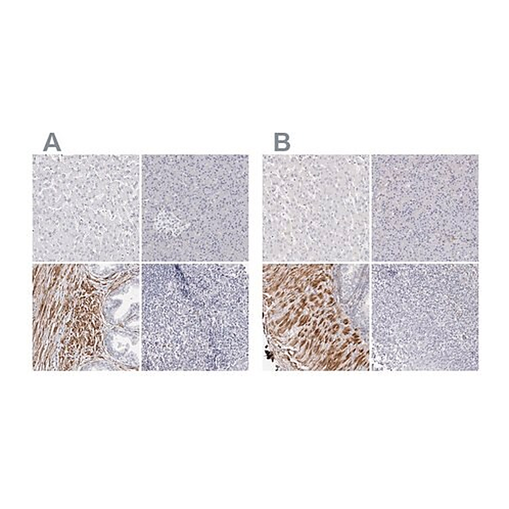 Merck Anti-LMOD1 antibody produced in rabbit