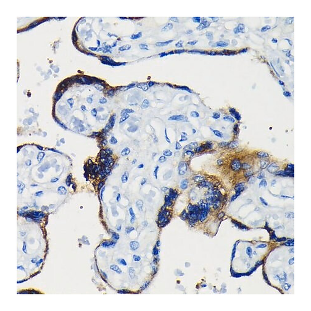 Merck Anti-Bcl-2 antibody produced in rabbit