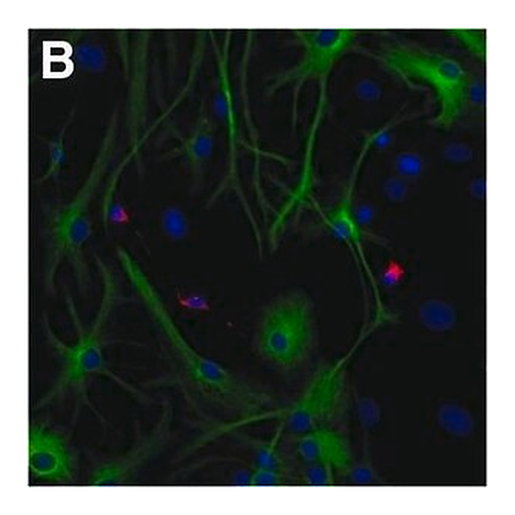 Merck MOUSE MONOCLONAL ANTI-MAP2 CLONE HM-2  &