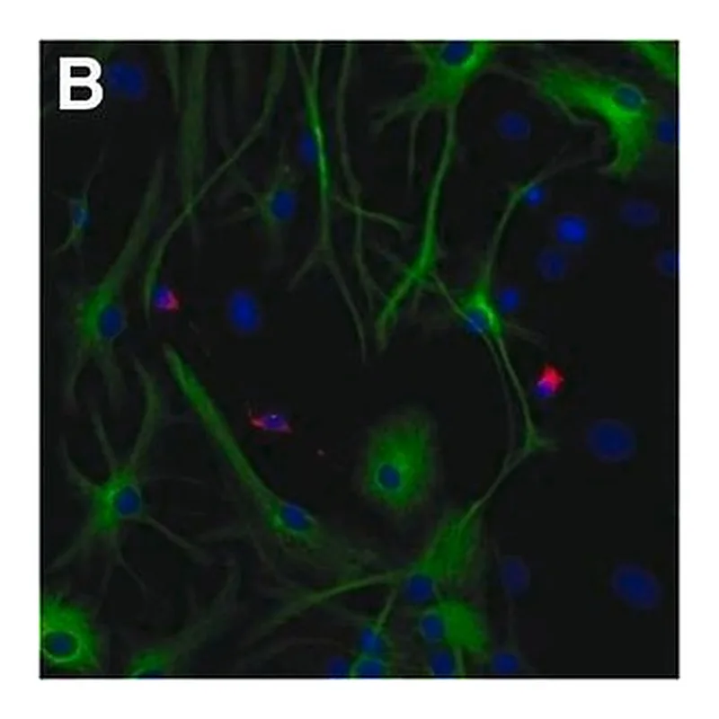 Merck MOUSE MONOCLONAL ANTI-MAP2 CLONE HM-2 &