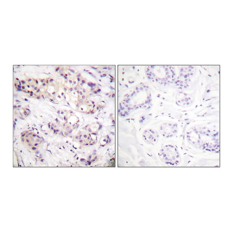 Merck Anti-PKC alpha antibody produced in rabbit