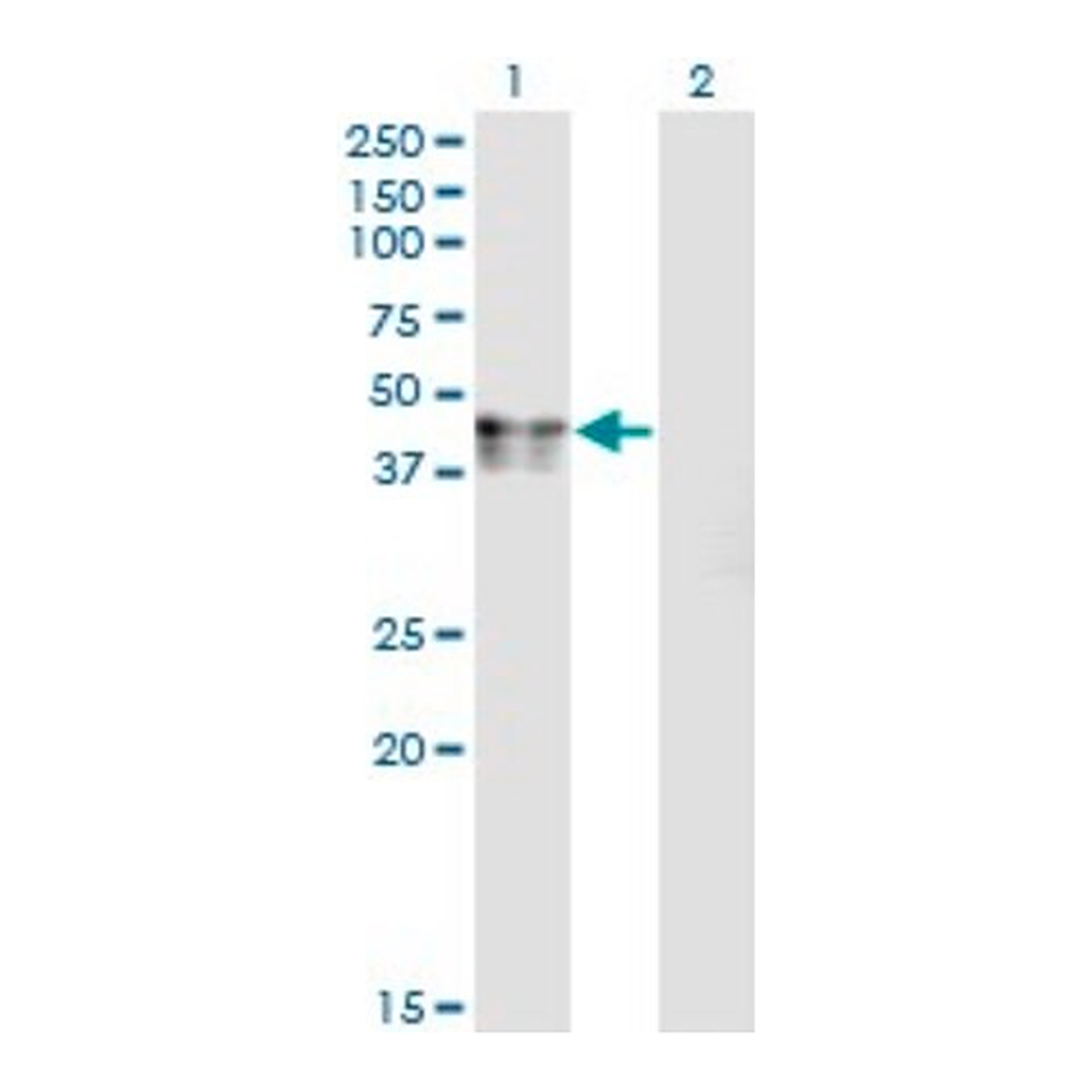 Merck Monoclonal Anti-CANT1 antibody produced in mouse