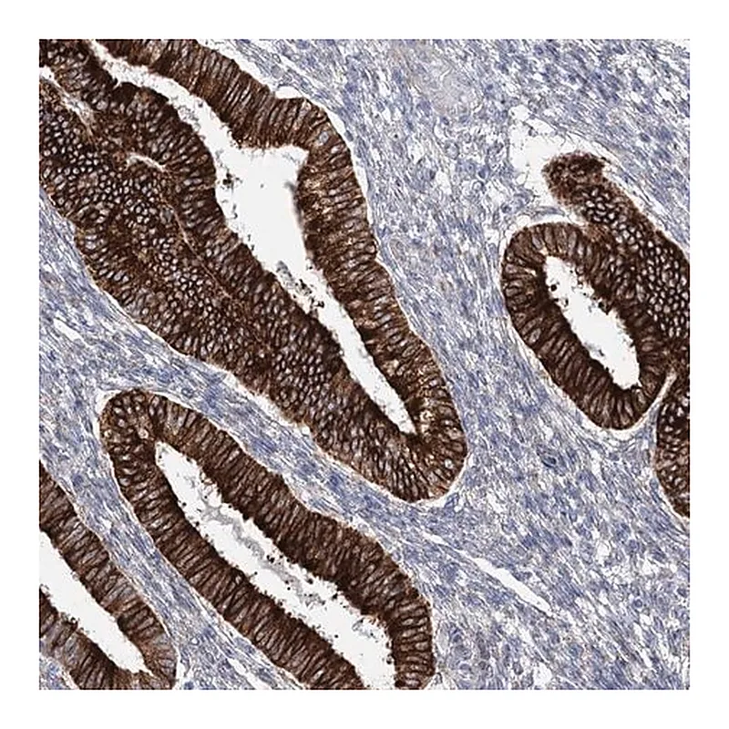 Merck Anti-YTHDC2 antibody produced in rabbit