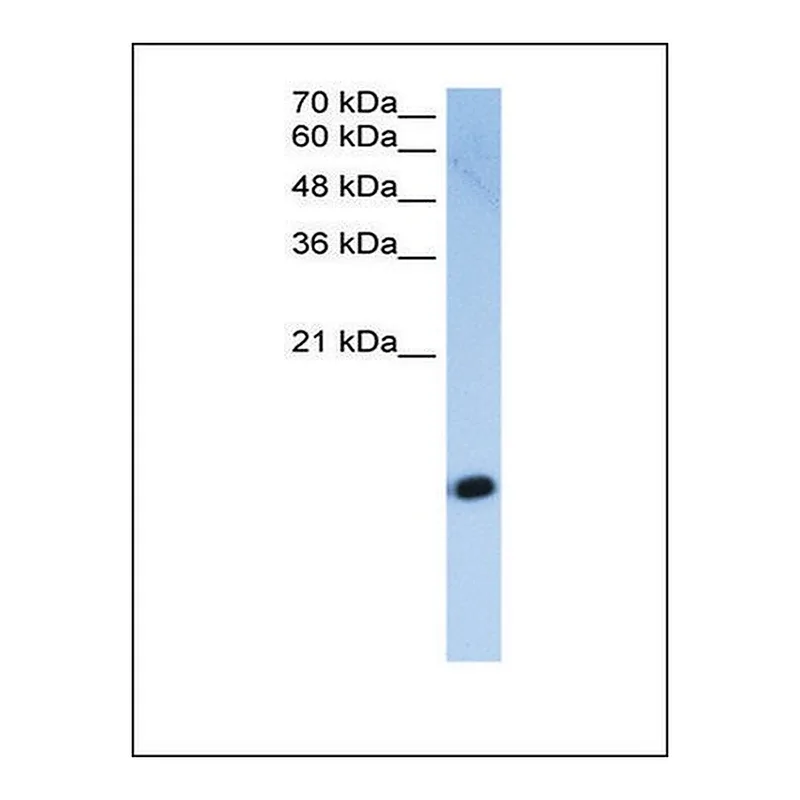 Merck Anti-HIST2H2AC antibody produced in rabbit