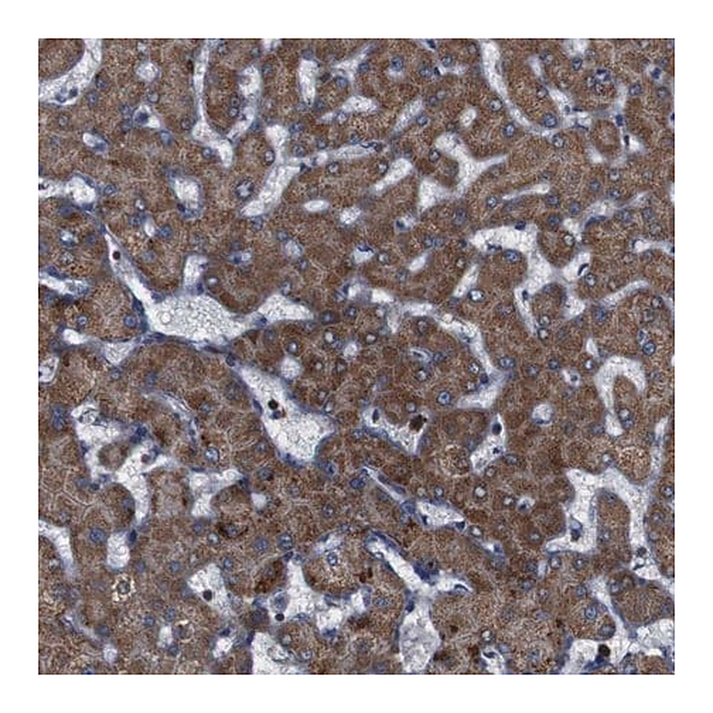 Merck Anti-ATP7B antibody produced in rabbit