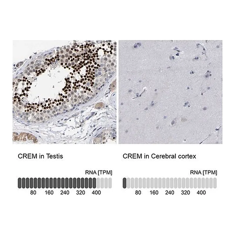 Merck Anti-CREM antibody produced in rabbit