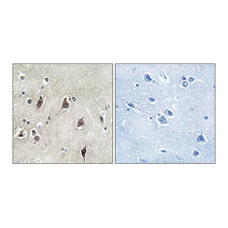 Merck Anti-p70 S6 Kinase antibody produced in rabbit