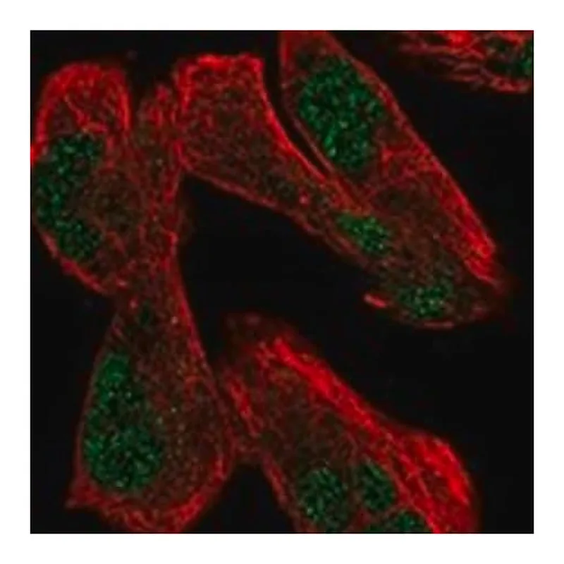 Merck Anti-USP12 antibody produced in rabbit