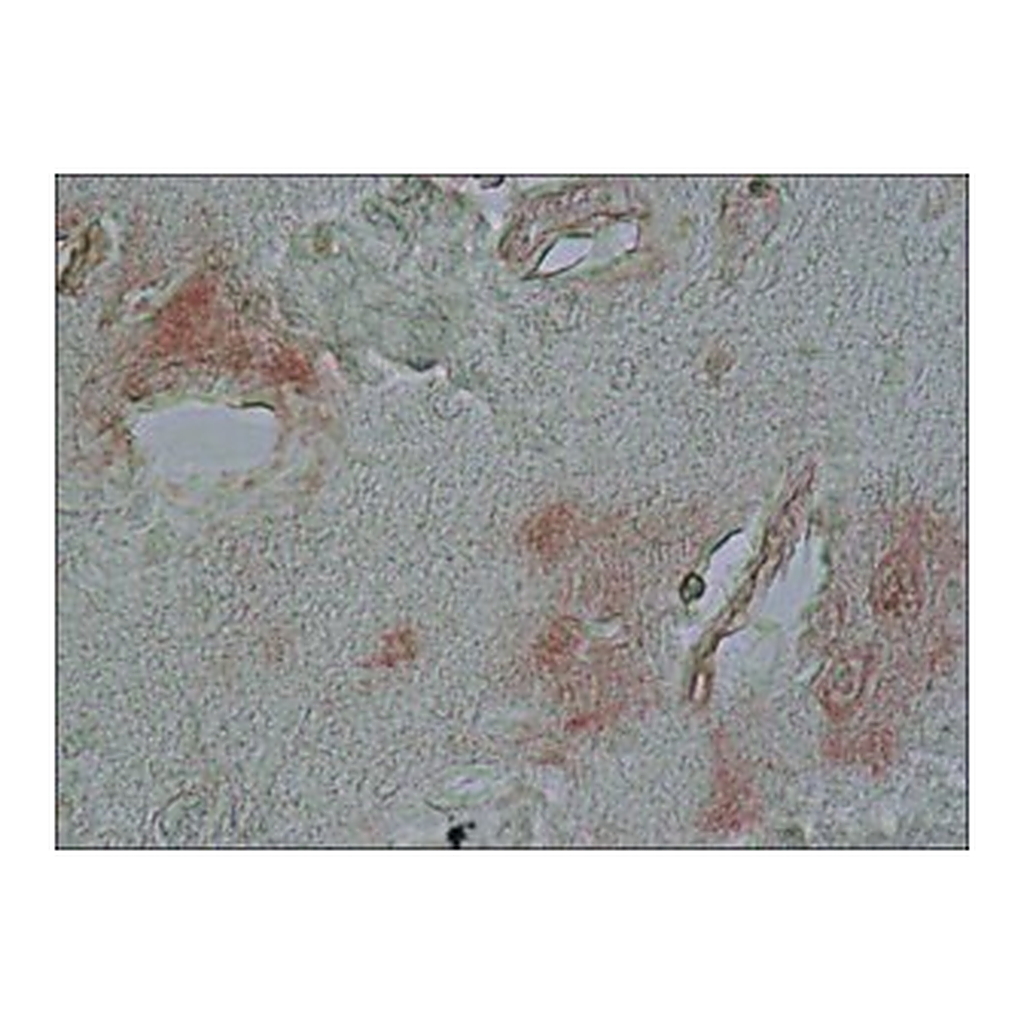 Merck ANTI-ALPHA-SYNUCLEIN , DEVELOPED IN    &