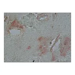 Merck ANTI-ALPHA-SYNUCLEIN , DEVELOPED IN &