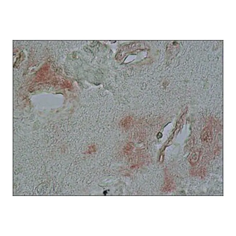 Merck ANTI-ALPHA-SYNUCLEIN , DEVELOPED IN &