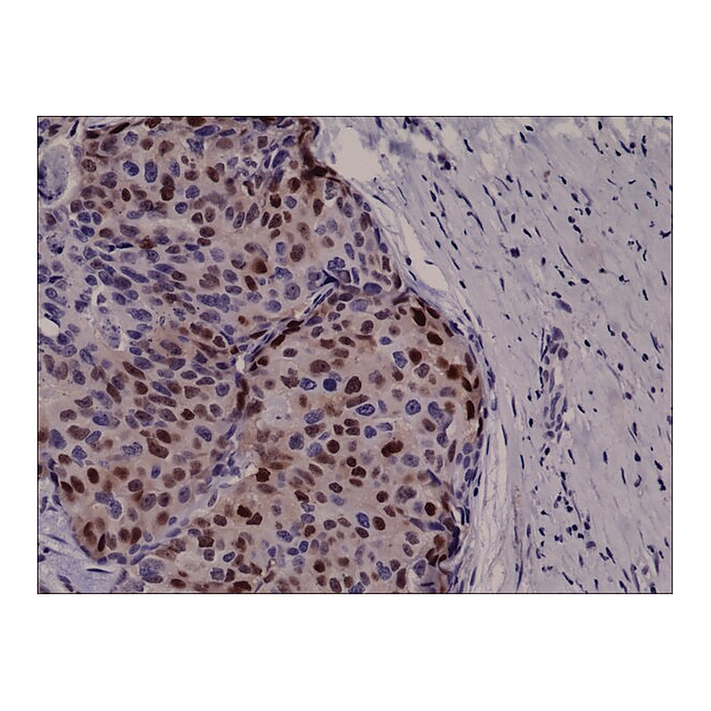 Merck Anti-Cyclin D1 antibody, Rabbit monoclonal