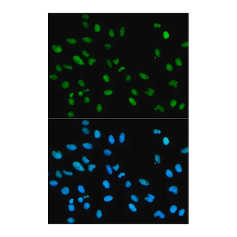 Merck Anti-RBBP4 antibody produced in rabbit