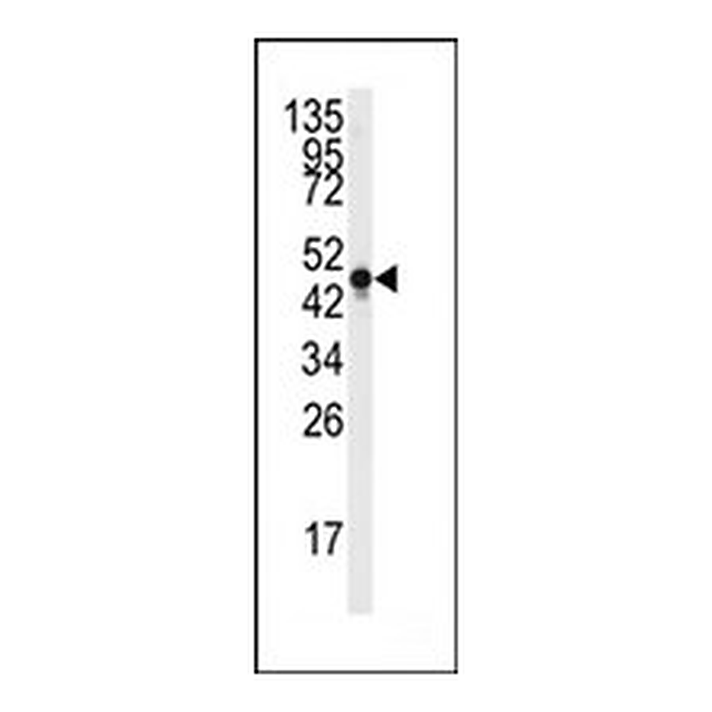 Merck ANTI-NSE (Y236)