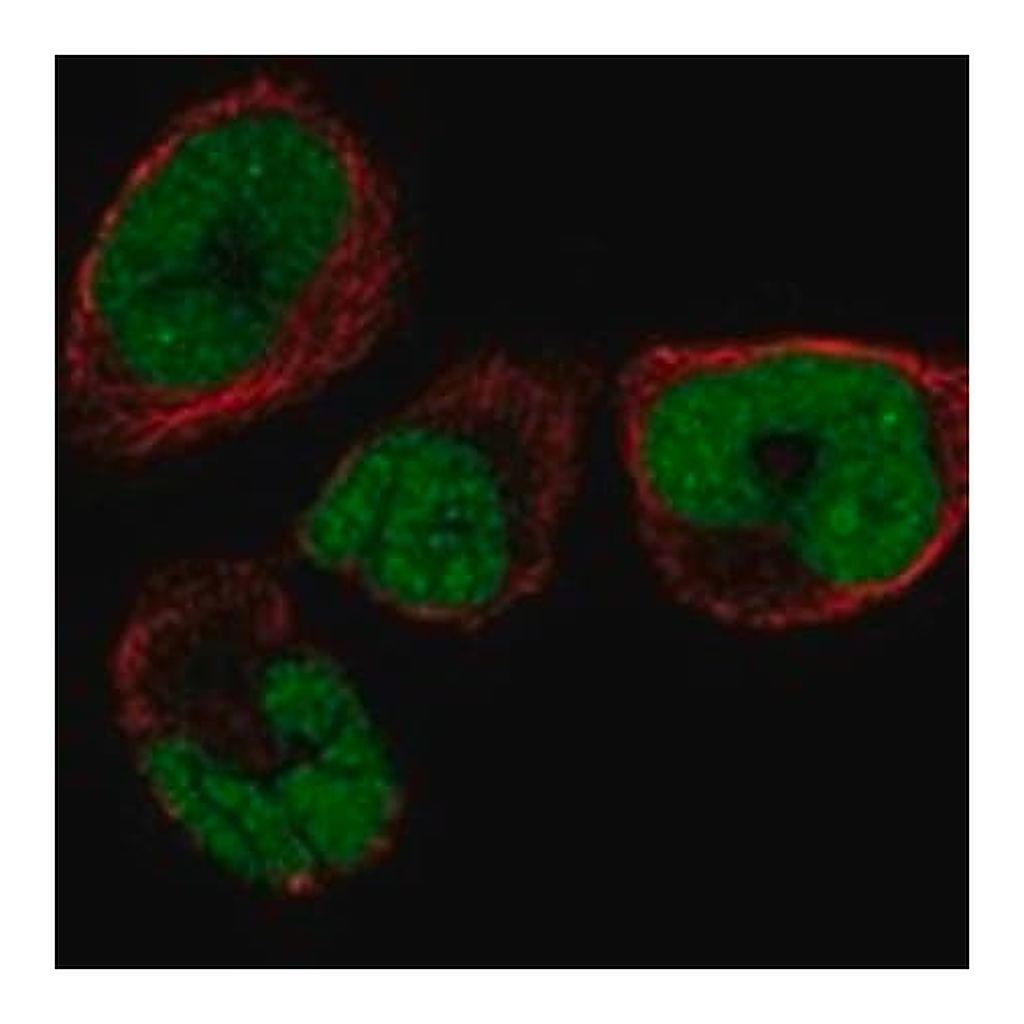 Merck Anti-SMNDC1 antibody produced in rabbit
