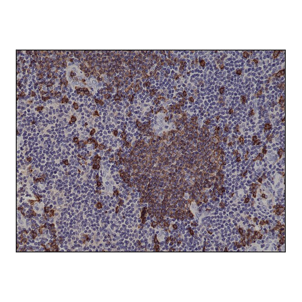Merck Anti-CD20 antibody, Rabbit monoclonal