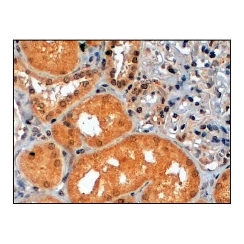 Merck Anti-P70S6K/RPS6KB1 antibody produced in goat