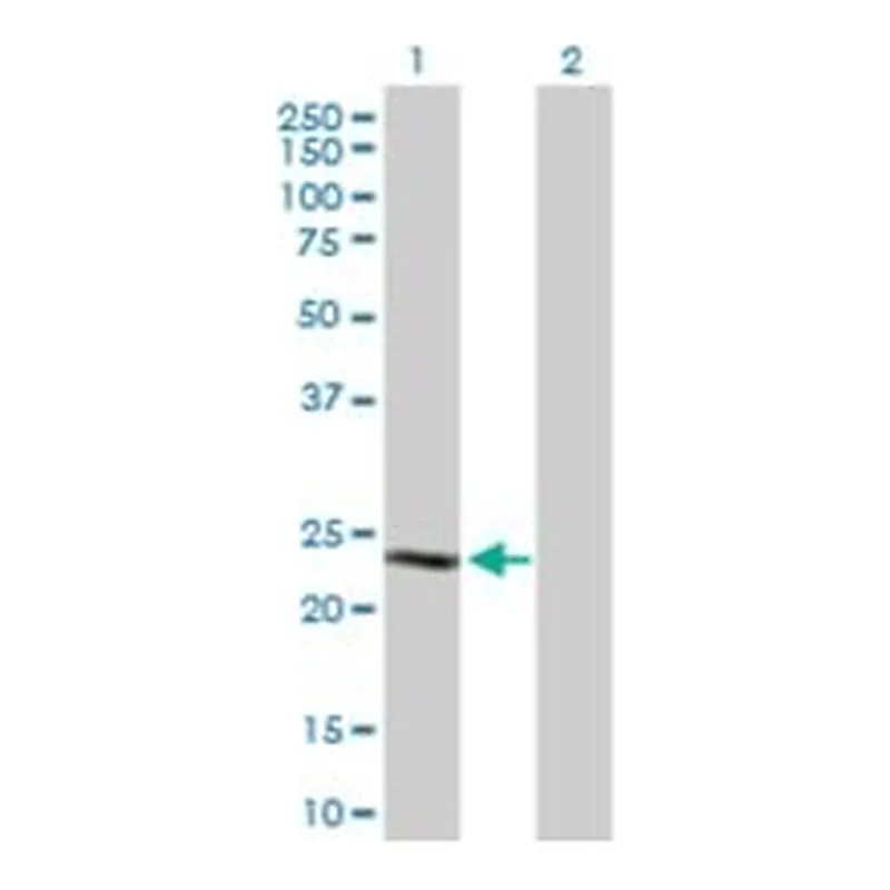 Merck ANTI-CSN1S1