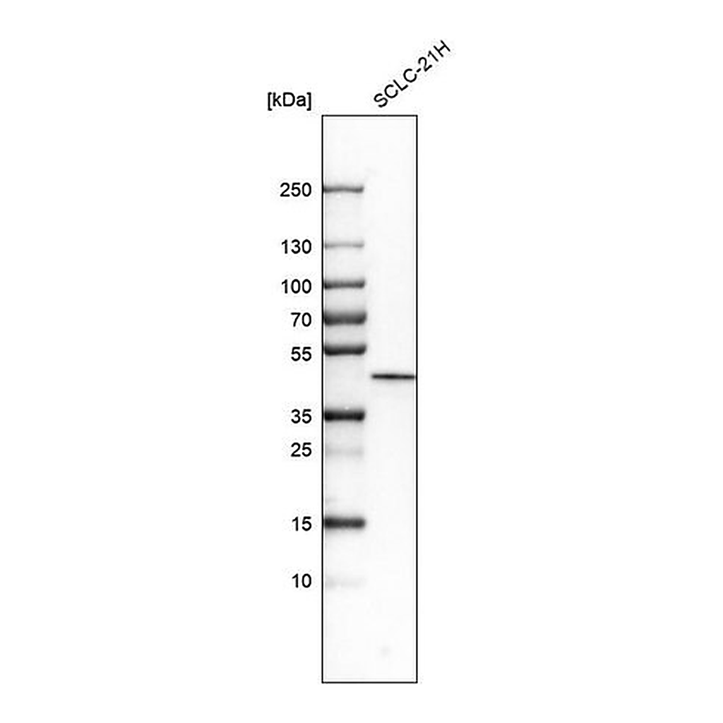 Merck Anti-CSNK1E antibody produced in rabbit