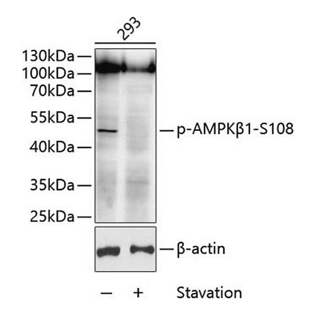 Merck Anti-Phospho-AMPKbeta1-S108 antibody produced in rabbit