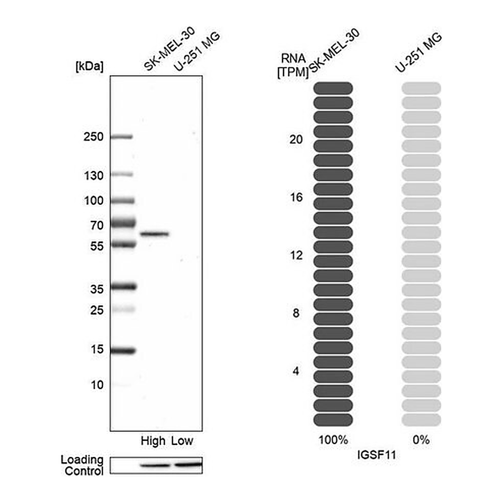 Merck Anti-IGSF11 antibody produced in rabbit