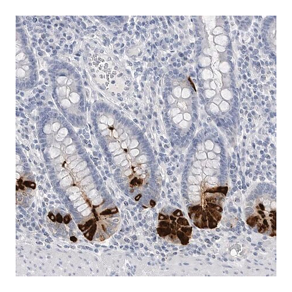 Merck Anti-ABHD12 antibody produced in rabbit