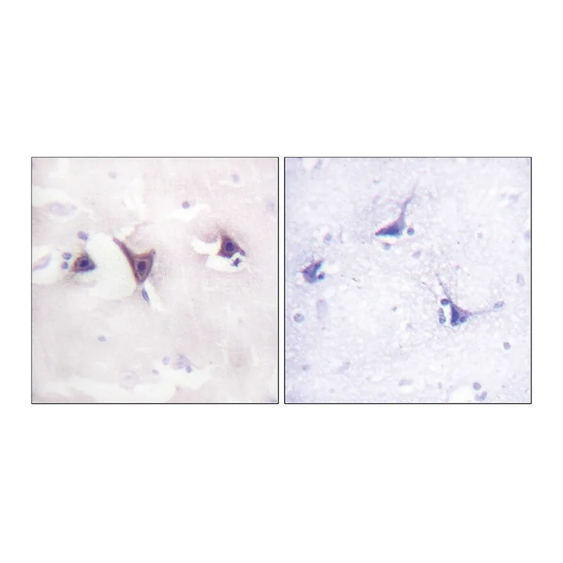 Merck Anti-TRK B antibody produced in rabbit