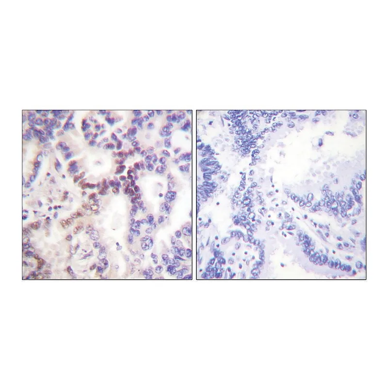 Merck Anti-p15 INK antibody produced in rabbit