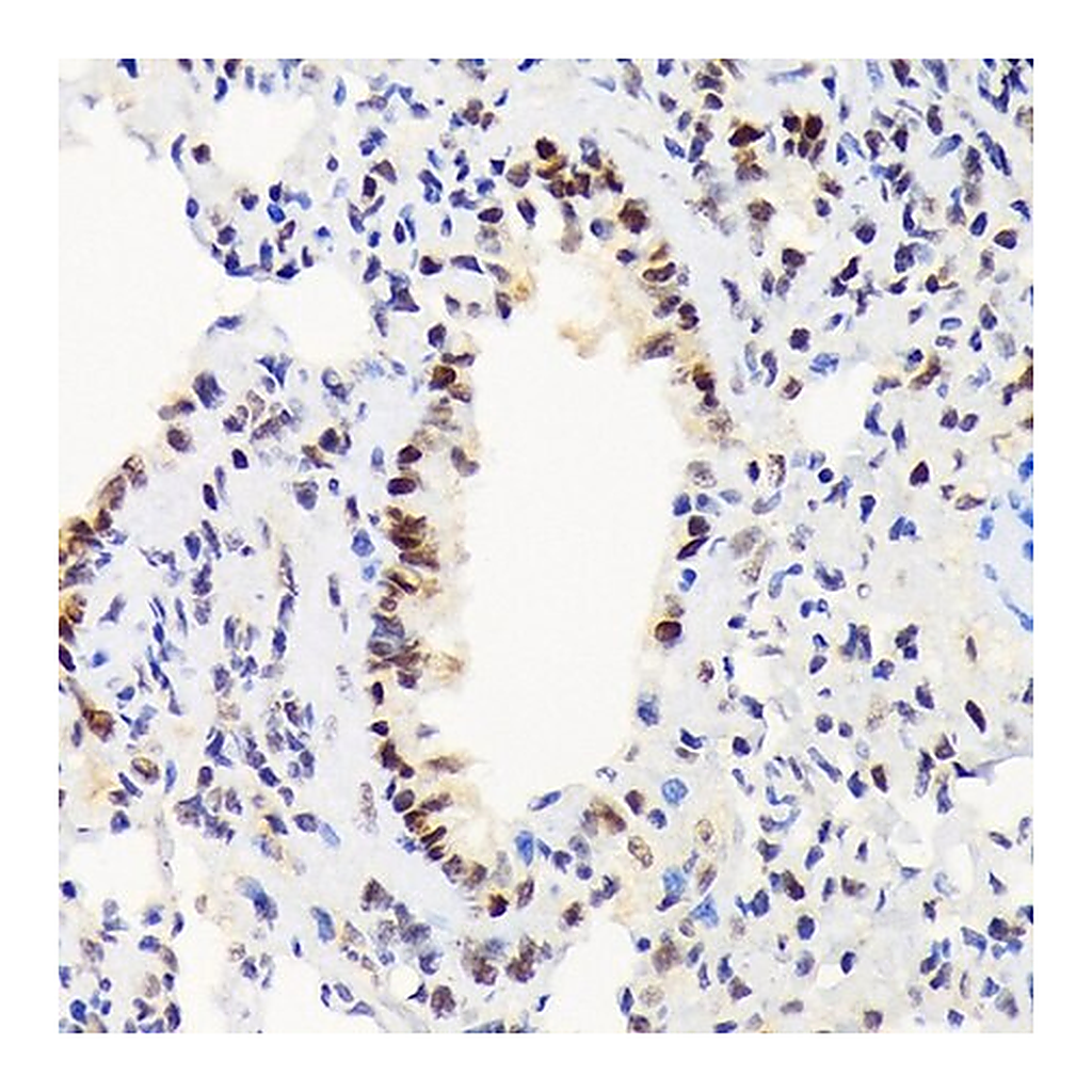 Merck Anti-EWSR1 antibody produced in rabbit