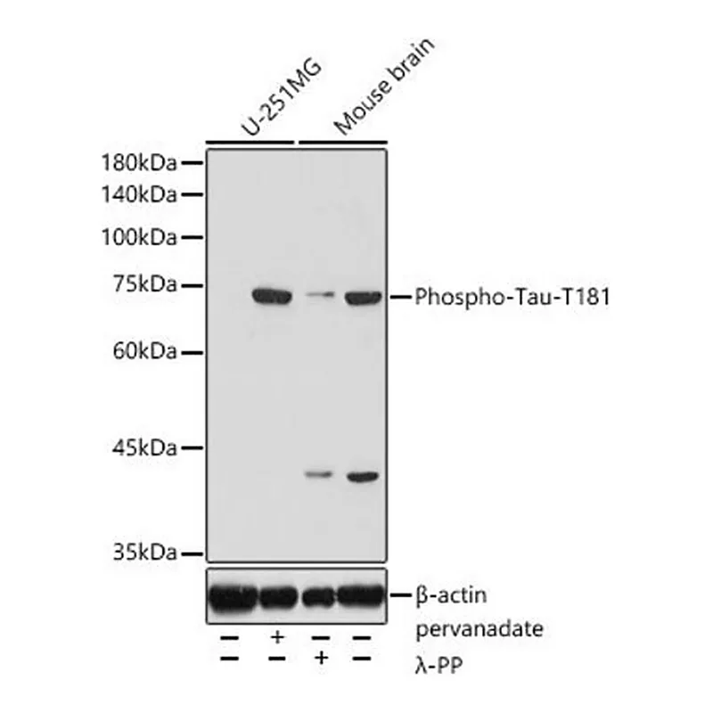 Merck Anti-Phospho-Tau-T181 antibody produced in rabbit