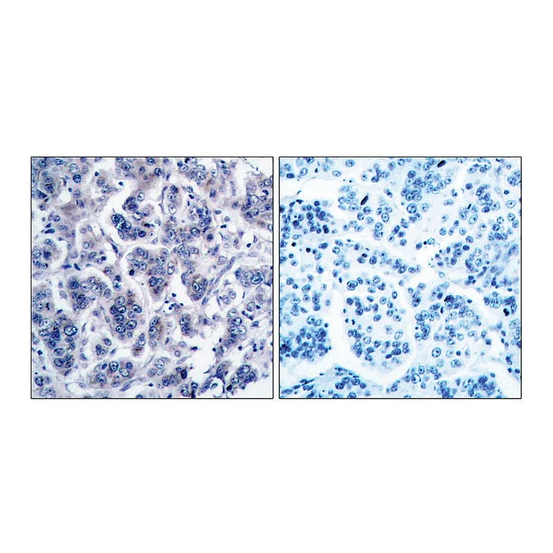 Merck Anti-TYK2 antibody produced in rabbit