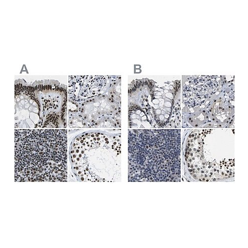 Merck Anti-NSRP1 antibody produced in rabbit