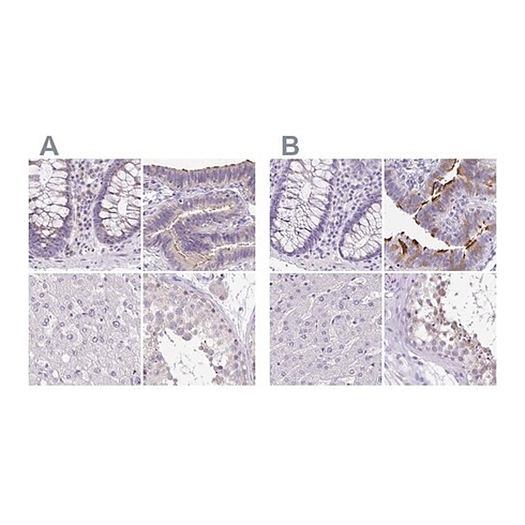 Merck Anti-ANKRD45 antibody produced in rabbit